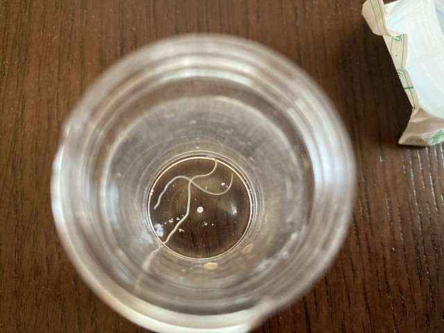 ブリの寄生虫はどんな種類がいる？寄生させない養殖法を教えて欲しい